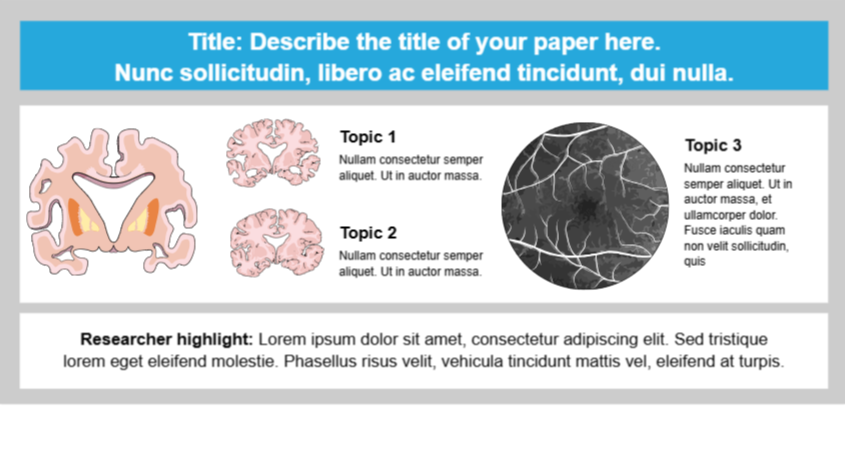 Graphical Abstracts template alzheimer disease associated disorders 4